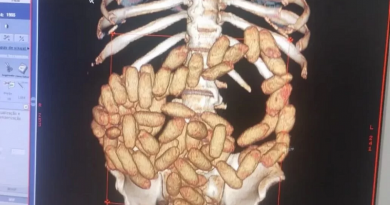 rsz_engoliu_capsula_2_