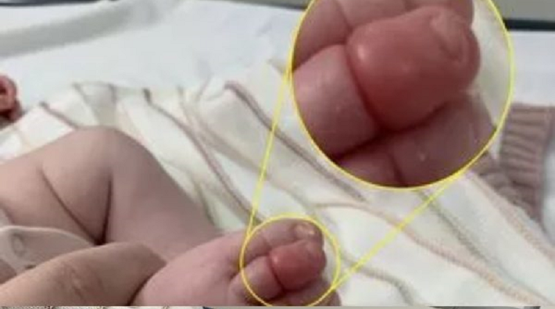 bebe-dedo-pe-600x600