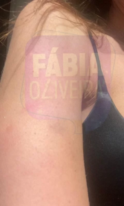 Cortes e hematomas: veja fotos de Maria Melilo após agressões do ex    Cortes e hematomas: veja fotos de Maria Melilo após agressões do ex    Cortes e hematomas: veja fotos de Maria Melilo após agressões do ex