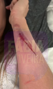Cortes e hematomas: veja fotos de Maria Melilo após agressões do ex    Cortes e hematomas: veja fotos de Maria Melilo após agressões do ex    Cortes e hematomas: veja fotos de Maria Melilo após agressões do ex