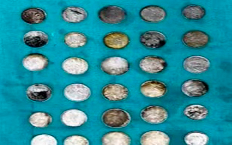 Os itens foram removidos em cirurgia (Foto: reprodução/Sir Ganga Ram Hospital)