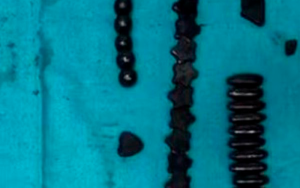 O paciente ficou sob observação por uma semana e recebeu alta após os médicos constatarem que o jovem estava bem (Foto: reprodução/Sir Ganga Ram Hospital)