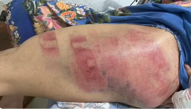 Bruna Tsuchiya compartilhou as fotos de como ficou após a agressão e tentativa de feminicídio. — Foto: Reprodução / Redes sociais