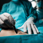 Paciente acorda durante cirurgia e flagra enfermeiro a estuprando em Cuiabá | MT