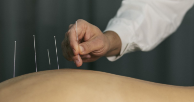 Acupuntura- Jornal Folha do Progresso