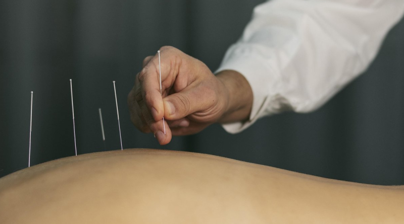 Acupuntura- Jornal Folha do Progresso