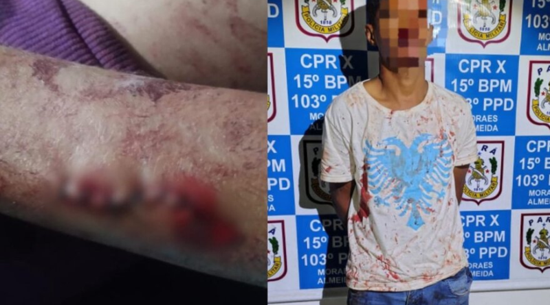 Tentativa de Feminicidio-Jornal Folha do Progresso