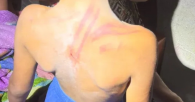 agressão contra criança-Jornal Folha do Progresso