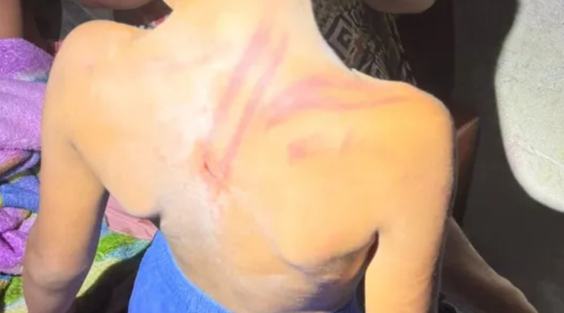 agressão contra criança-Jornal Folha do Progresso